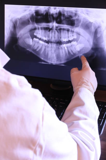 Best Emergency Treatment for Dental Infections or Abscesses in Winthrop, MN