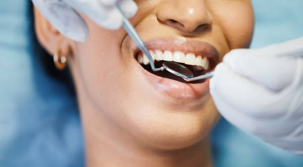 Best Urgent Care for Lost Fillings or Crowns in Winthrop, MN