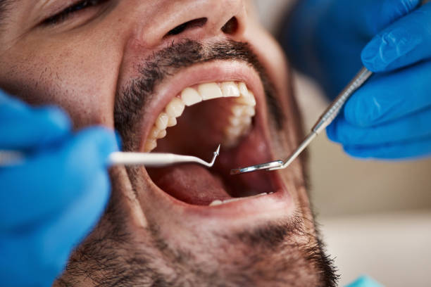 Best Emergency Treatment for Dental Infections or Abscesses in Winthrop, MN