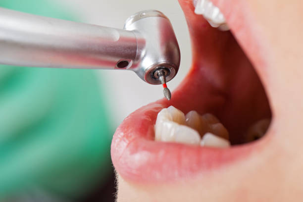Best Weekend Emergency Dentist in Winthrop, MN